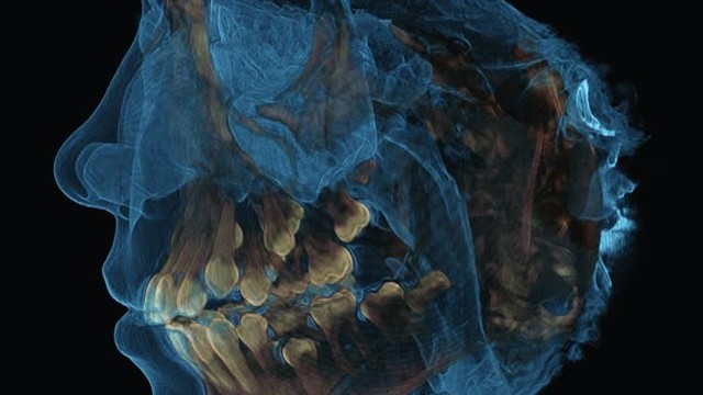 3d dental radiography