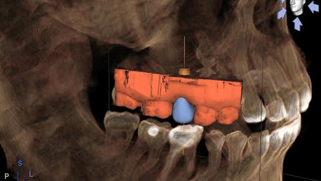 3d dental radiography