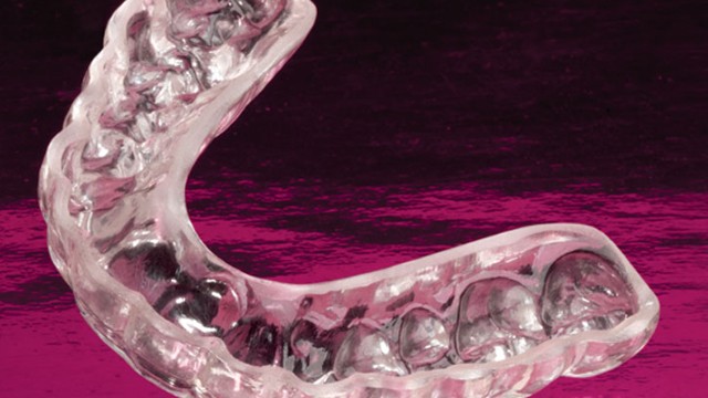 mouthguard