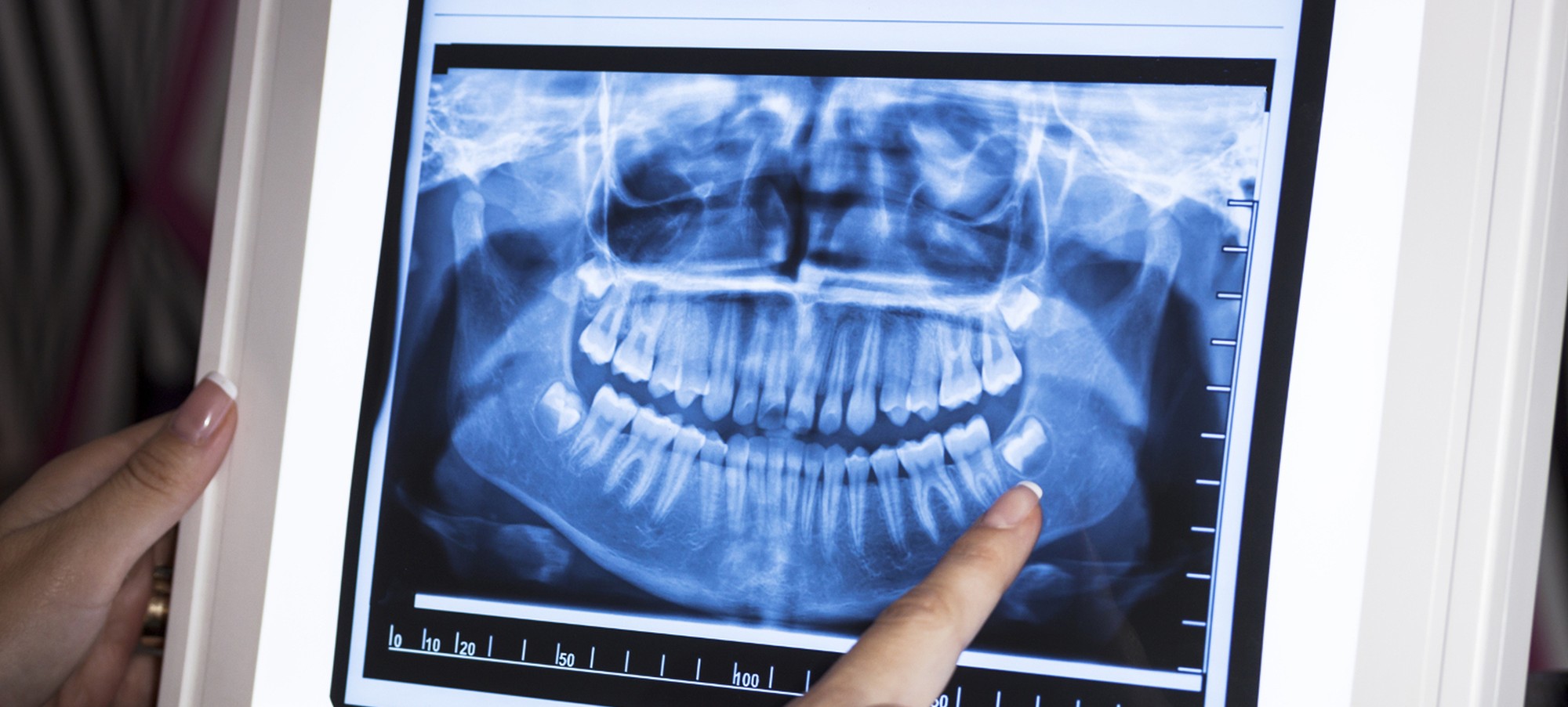 3d dental radiography